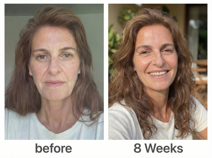 <em>Reduces Wrinkles & Tightens</em> Sagging Skin