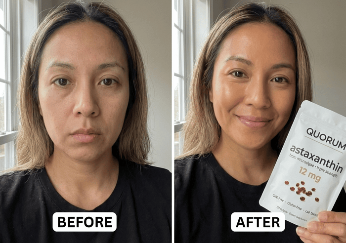 It's Trending Everywhere (And The Before-and-Afters Speak for Themselves)